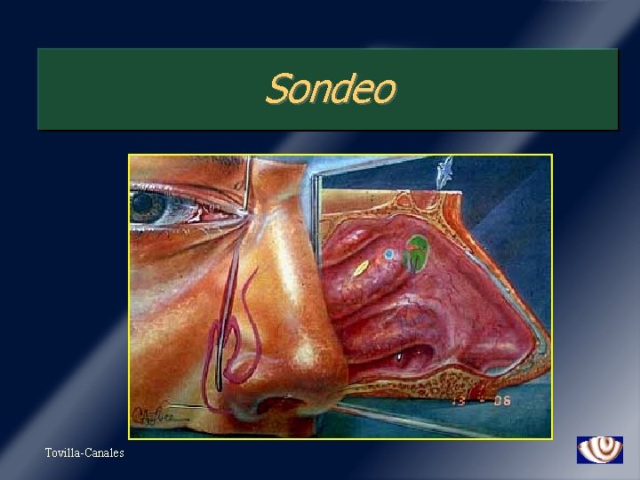 Sondeo Tovilla-Canales 