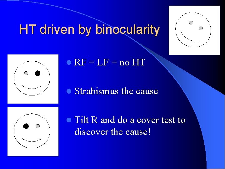 HT driven by binocularity l RF = LF = no HT l Strabismus l