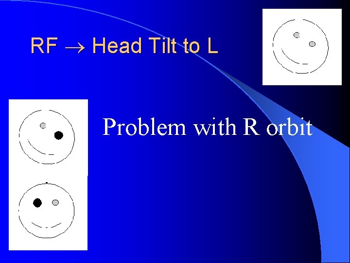 RF Head Tilt to L Problem with R orbit 