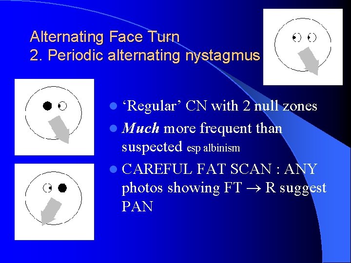 Alternating Face Turn 2. Periodic alternating nystagmus l ‘Regular’ CN with 2 null zones