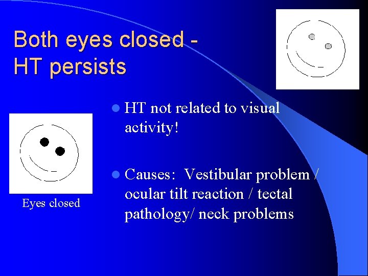 Both eyes closed HT persists l HT not related to visual activity! l Causes: