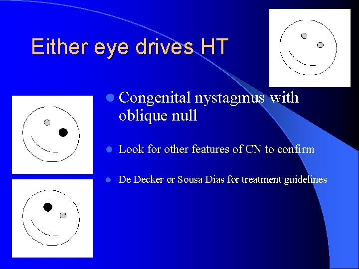 Either eye drives HT l Congenital nystagmus with oblique null l Look for other