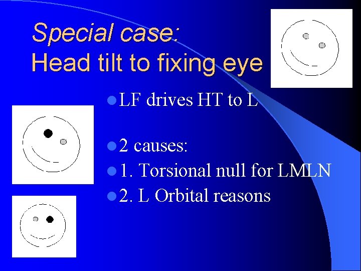 Special case: Head tilt to fixing eye l LF l 2 drives HT to