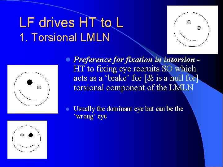 LF drives HT to L 1. Torsional LMLN l Preference for fixation in intorsion