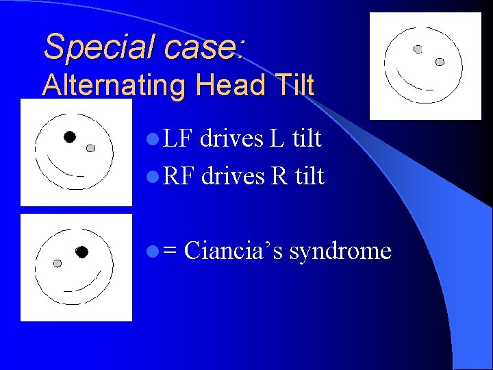 Special case: Alternating Head Tilt l LF drives L tilt l RF drives R