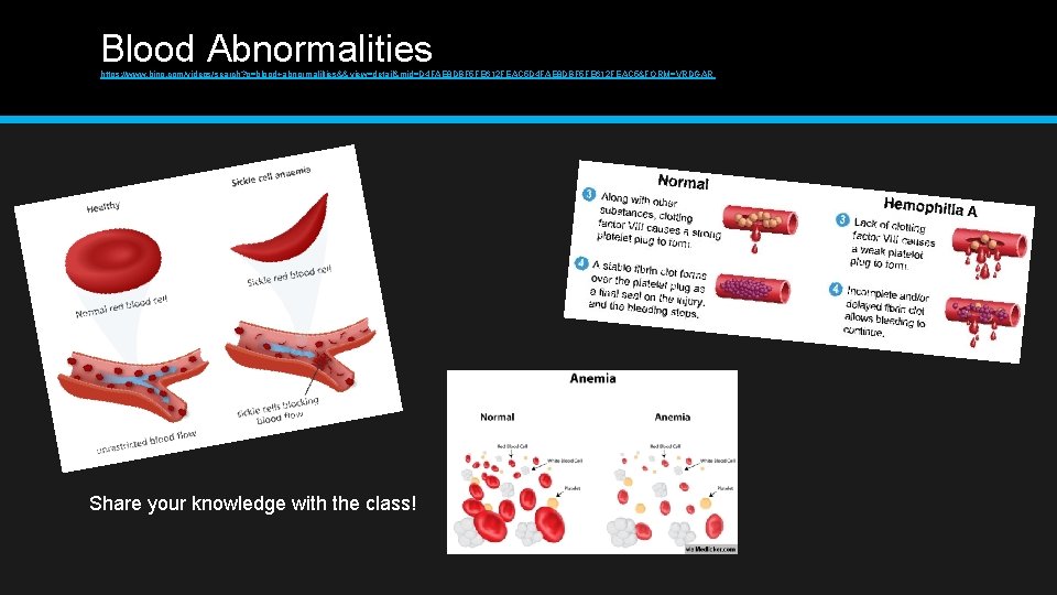 Blood Abnormalities https: //www. bing. com/videos/search? q=blood+abnormalilties&& view=detail&mid=D 4 FAE 8 DBF 5 FE