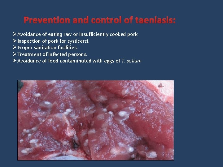 Prevention and control of taeniasis: ØAvoidance of eating raw or insufficiently cooked pork ØInspection