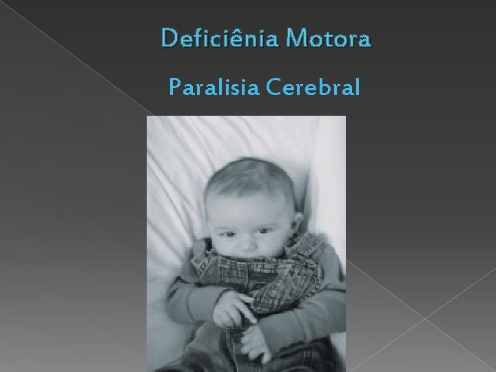 Deficiênia Motora Paralisia Cerebral 