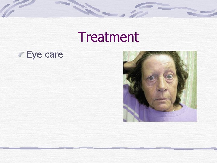 Treatment Eye care 