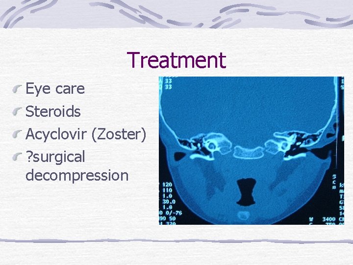 Treatment Eye care Steroids Acyclovir (Zoster) ? surgical decompression 