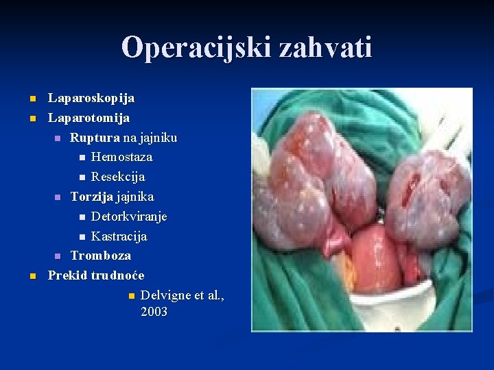 Operacijski zahvati n n n Laparoskopija Laparotomija n Ruptura na jajniku n Hemostaza n