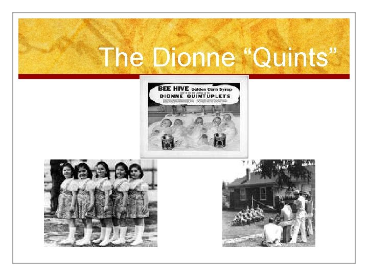 The Dionne “Quints” 