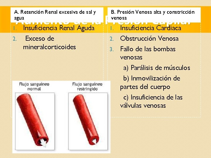 A. Retención Renal excesiva de sal y agua B. Presión Venosa alta y constricción