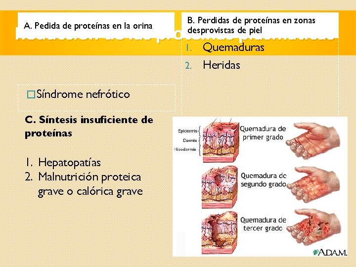 A. Pedida de proteínas en la orina B. Perdidas de proteínas en zonas desprovistas