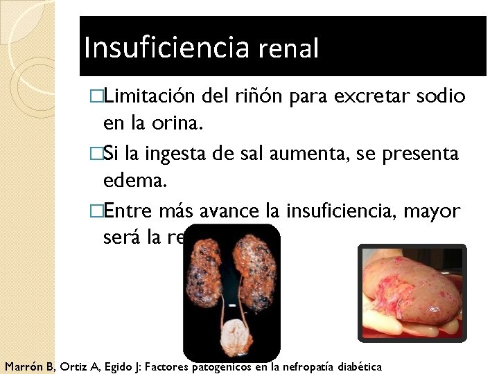 Insuficiencia renal �Limitación del riñón para excretar sodio en la orina. �Si la ingesta