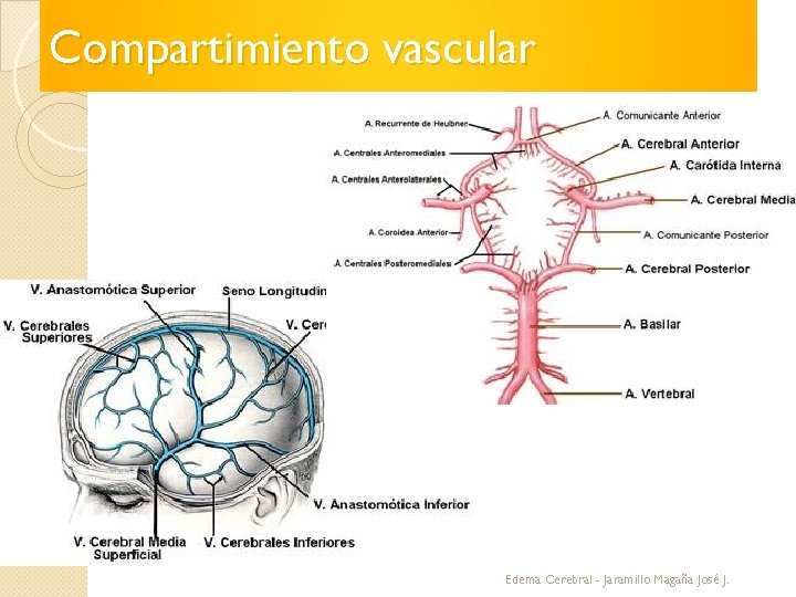 Compartimiento vascular Edema Cerebral - Jaramillo Magaña José J. 