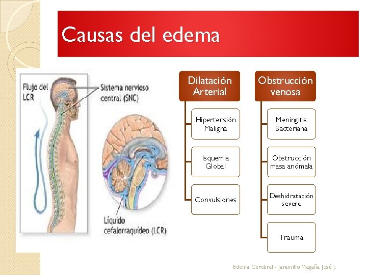 Causas del edema Dilatación Arterial Obstrucción venosa Hipertensión Maligna Meningitis Bacteriana Isquemia Global Obstrucción