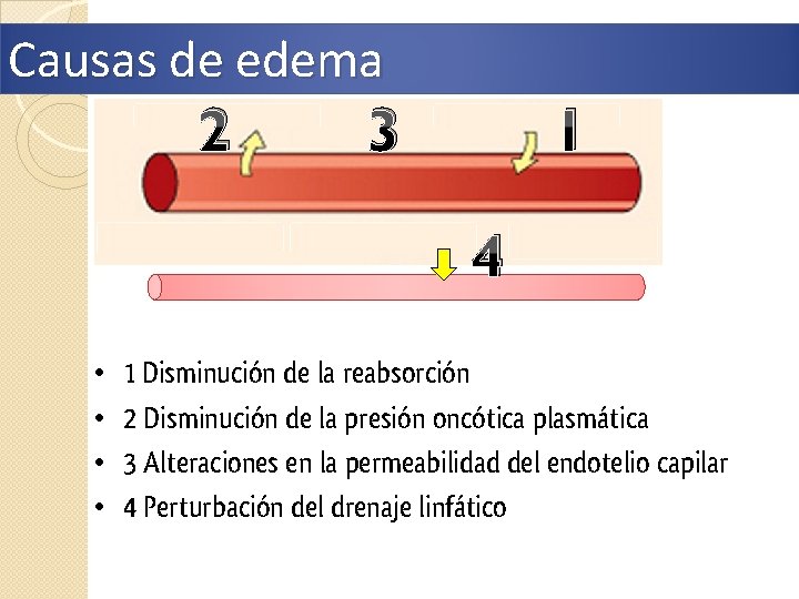 Causas de edema 2 3 1 4 • • 1 Disminución de la reabsorción