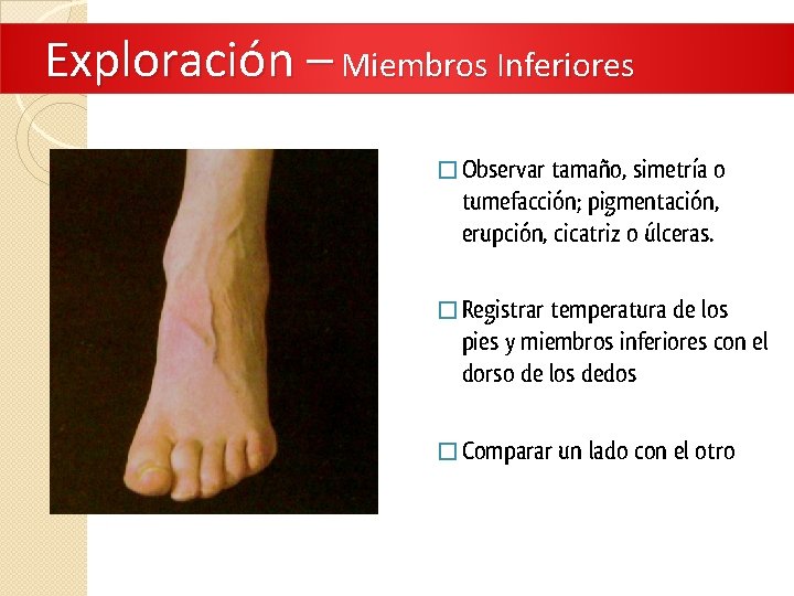 Exploración – Miembros Inferiores � Observar tamaño, simetría o tumefacción; pigmentación, erupción, cicatriz o