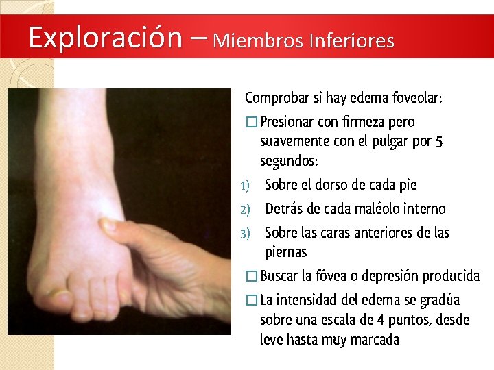 Exploración – Miembros Inferiores Comprobar si hay edema foveolar: � Presionar con firmeza pero