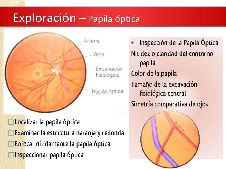 Exploración – Papila óptica • Inspección de la Papila Óptica Nitidez o claridad del