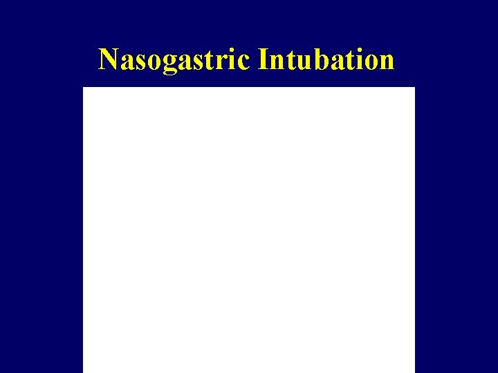 Nasogastric Intubation 