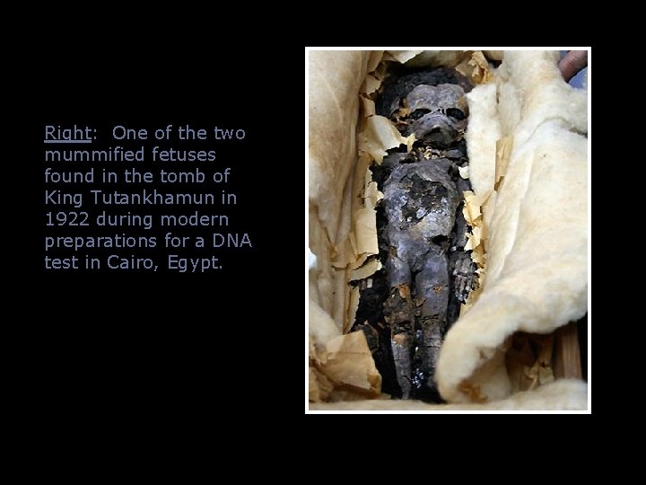 Right: One of the two mummified fetuses found in the tomb of King Tutankhamun Right: One of the two mummified fetuses found in the tomb of King Tutankhamun