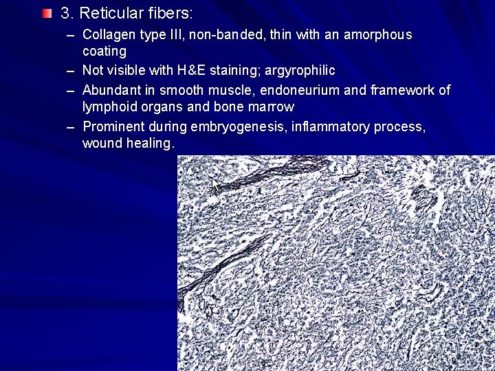 3. Reticular fibers: – Collagen type III, non-banded, thin with an amorphous coating – 3. Reticular fibers: – Collagen type III, non-banded, thin with an amorphous coating –