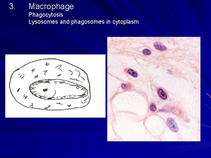 3. Macrophage Phagocytosis Lysosomes and phagosomes in cytoplasm 3. Macrophage Phagocytosis Lysosomes and phagosomes in cytoplasm