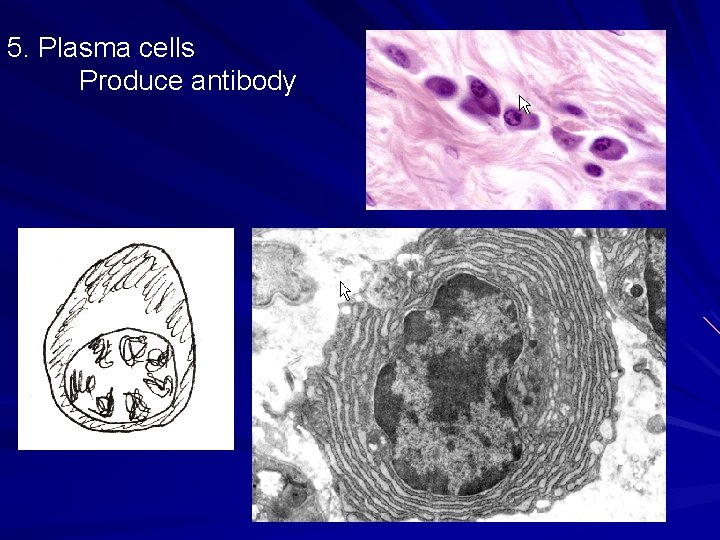 5. Plasma cells Produce antibody 5. Plasma cells Produce antibody