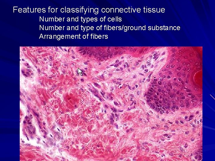 Features for classifying connective tissue Number and types of cells Number and type of Features for classifying connective tissue Number and types of cells Number and type of