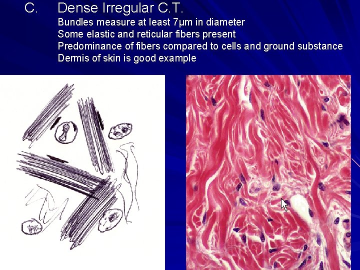C. Dense Irregular C. T. Bundles measure at least 7μm in diameter Some elastic C. Dense Irregular C. T. Bundles measure at least 7μm in diameter Some elastic