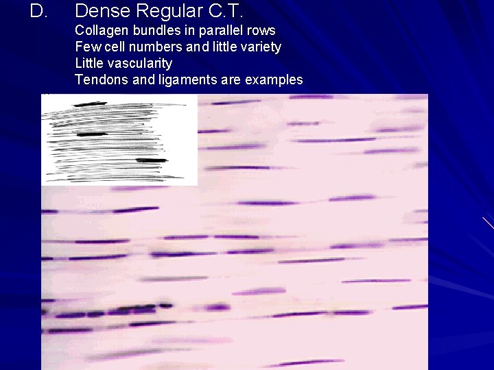 D. Dense Regular C. T. Collagen bundles in parallel rows Few cell numbers and D. Dense Regular C. T. Collagen bundles in parallel rows Few cell numbers and
