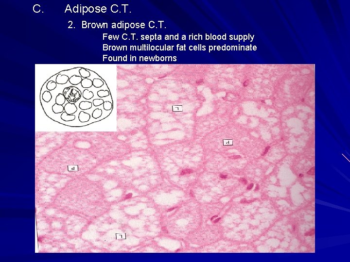 C. Adipose C. T. 2. Brown adipose C. T. Few C. T. septa and C. Adipose C. T. 2. Brown adipose C. T. Few C. T. septa and