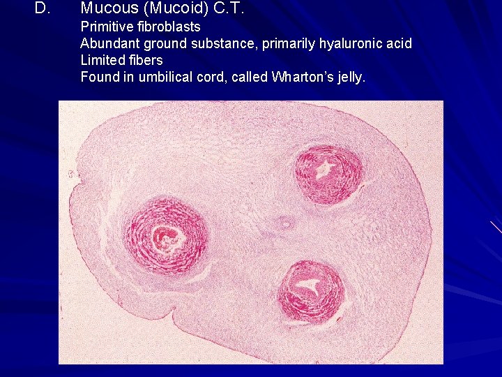 D. Mucous (Mucoid) C. T. Primitive fibroblasts Abundant ground substance, primarily hyaluronic acid Limited D. Mucous (Mucoid) C. T. Primitive fibroblasts Abundant ground substance, primarily hyaluronic acid Limited