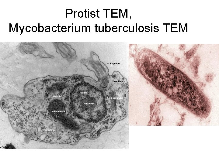 Protist TEM, Mycobacterium tuberculosis TEM 