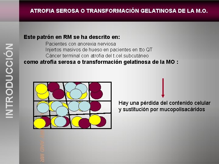 ATROFIA SEROSA O TRANSFORMACIÓN GELATINOSA DE LA M. O. Pacientes con anorexia nerviosa Injertos