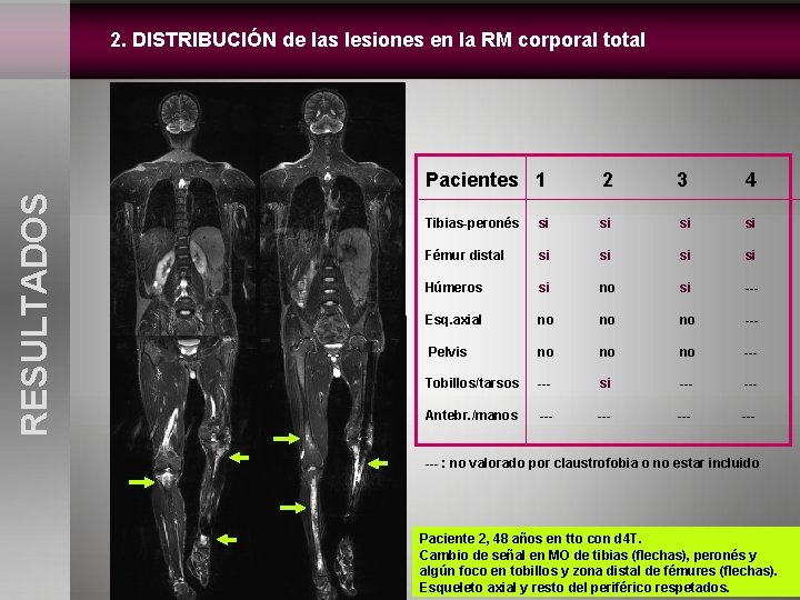 Pacientes 1 2 3 4 Tibias-peronés si si Fémur distal si si Húmeros si