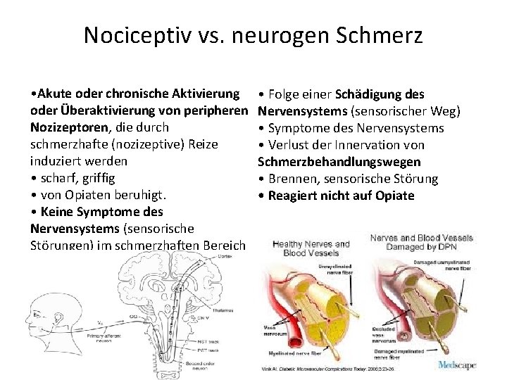 Nociceptiv vs. neurogen Schmerz • Akute oder chronische Aktivierung oder Überaktivierung von peripheren Nozizeptoren,