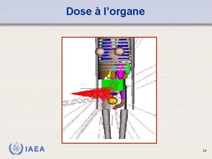 Dose à l’organe IAEA 24 
