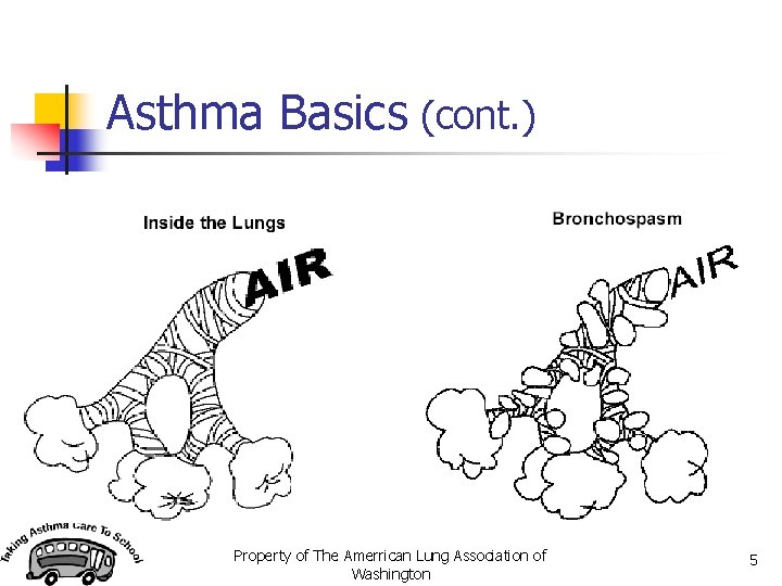 Asthma Basics (cont. ) Property of The Amerrican Lung Association of Washington 5 