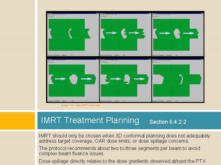 Image From: www. IMRTCenter. com IMRT Treatment Planning Section 6. 4. 2. 2 IMRT