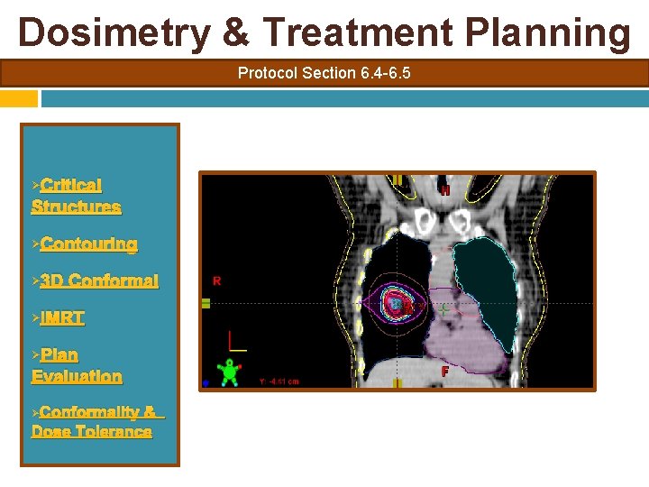 Dosimetry & Treatment Planning Protocol Section 6. 4 -6. 5 Critical Structures Ø Ø