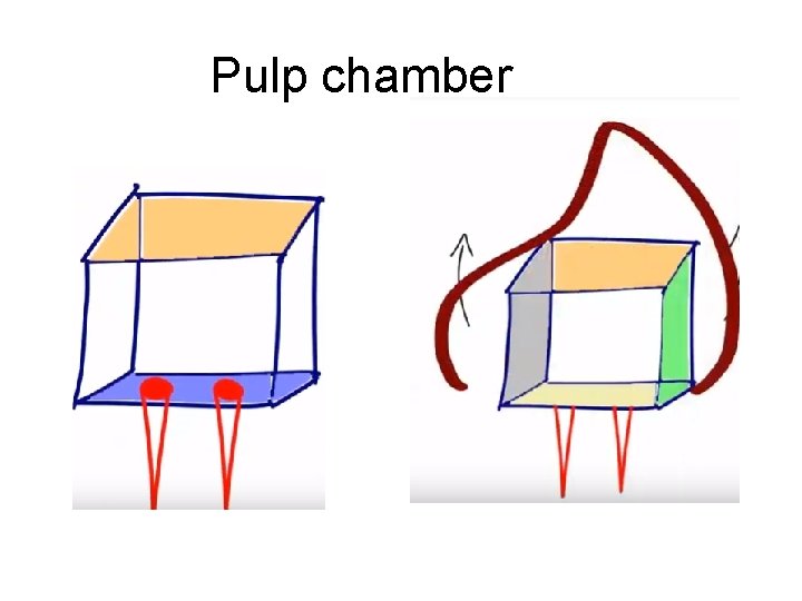 Pulp chamber 
