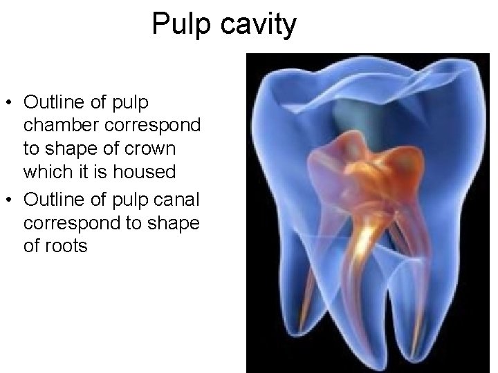 Pulp cavity • Outline of pulp chamber correspond to shape of crown which it