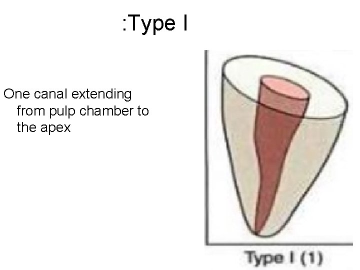 : Type I One canal extending from pulp chamber to the apex 
