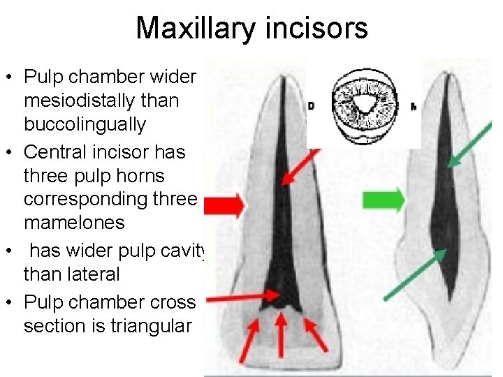 Maxillary incisors • Pulp chamber wider mesiodistally than buccolingually • Central incisor has three