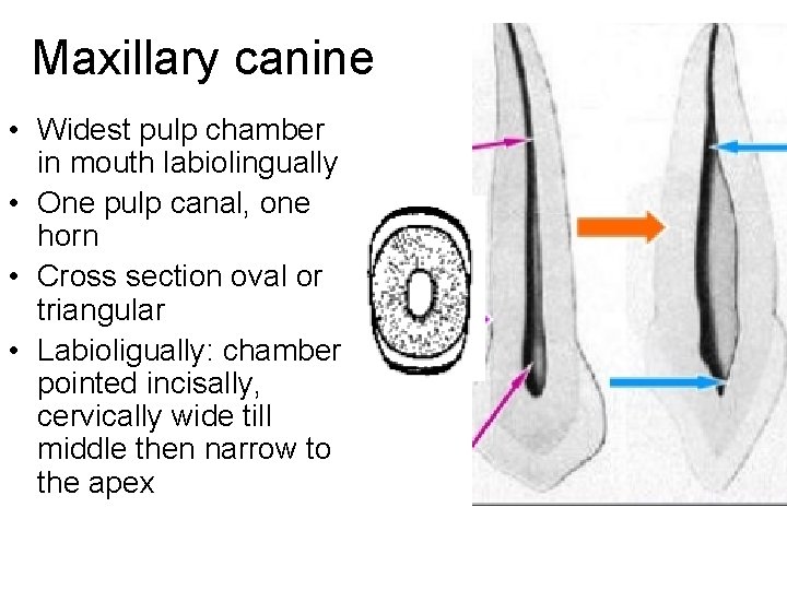 Maxillary canine • Widest pulp chamber in mouth labiolingually • One pulp canal, one