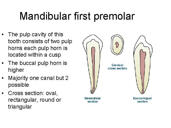 Mandibular first premolar • The pulp cavity of this tooth consists of two pulp