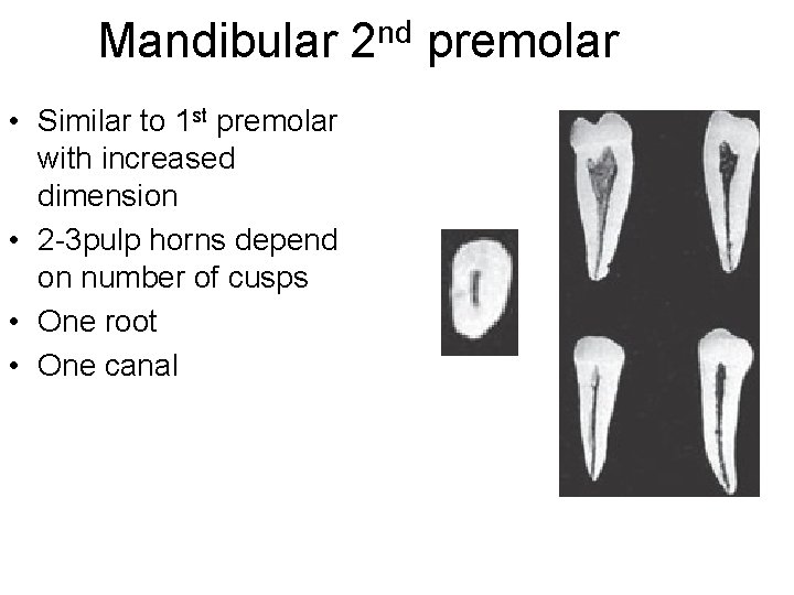 Mandibular • Similar to 1 st premolar with increased dimension • 2 -3 pulp